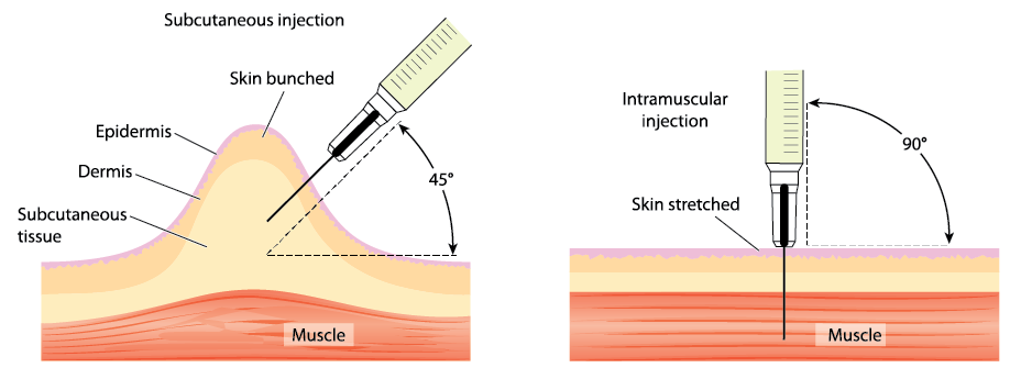 subcutaneous vs intramuscular injections