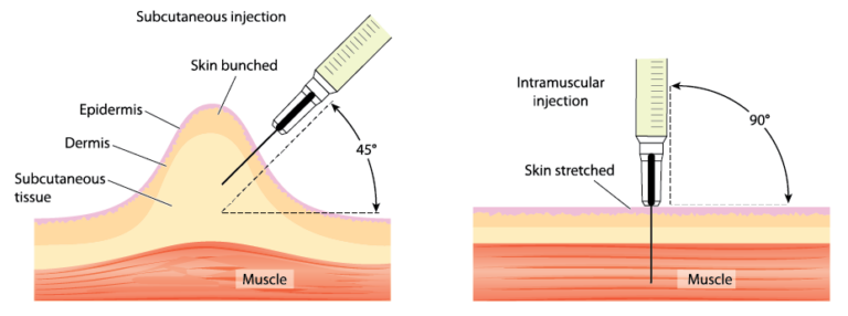 How To Give Yourself an Intramuscular Injection - IV Me Now FL